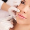 juvederm-ultra-smile-sublimer-levres-2